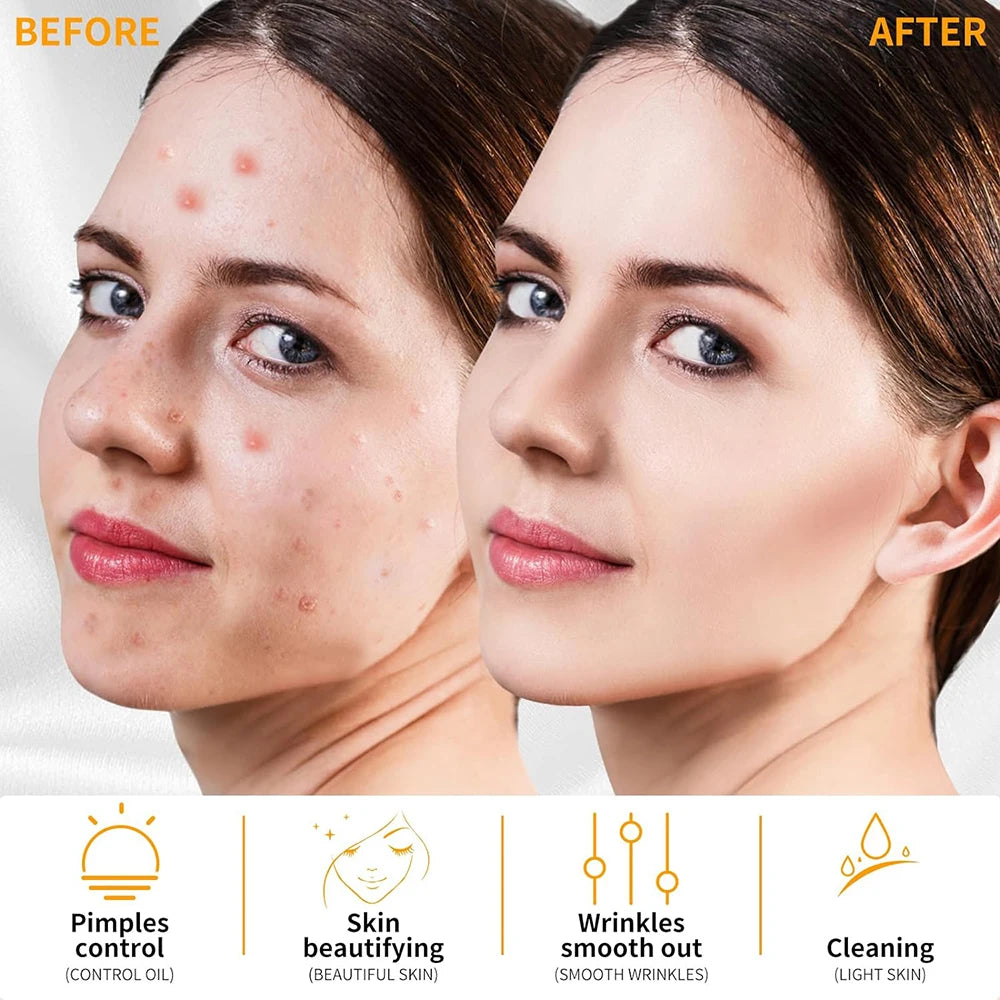 Face Wrinkle Reducing Machine