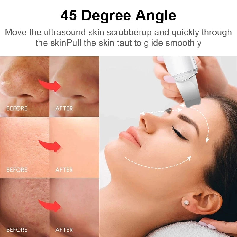 Skin Peeling & Lifting Device