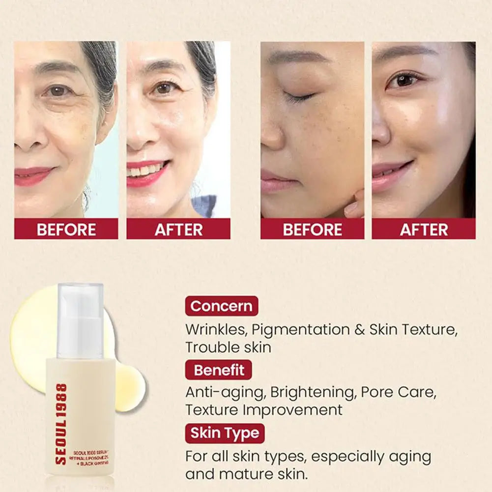 Korean SEOUL 1988 Serum Moisturizing Whitening Vitamin C Hyaluronic Acid Moisturizing Fade spots Shrink Pores Skin Care